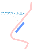 @̔e`|@p̎ށuANAWF@v