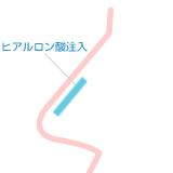 @̔e`|@p̎ށuqA_@v